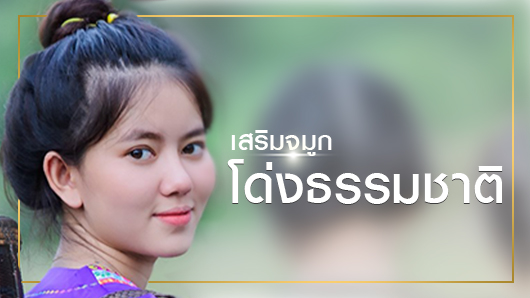 เสริมจมูกโด่งธรรมชาติ