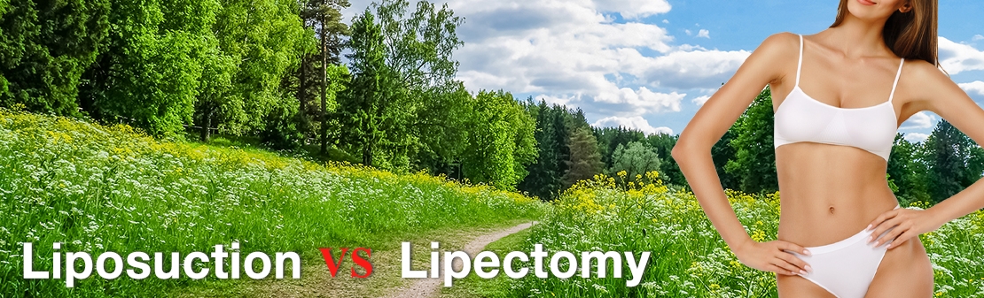 "Liposuction vs Lipectomy"