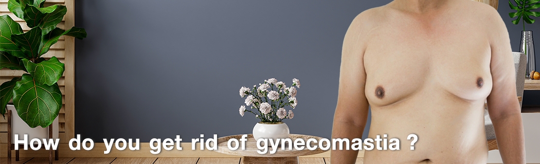 "How do you get rid of gynecomastia?"