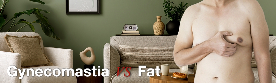 Gynecomastia vs Fat