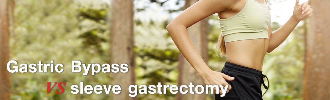 "Sleeve gastrectomy vs Gastric bypass"