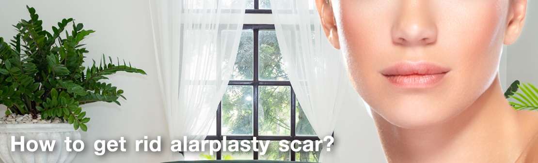 How to get rid of Alarplasty scar