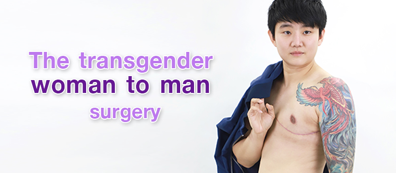 How to take good care of yourself post transgender men surgery?