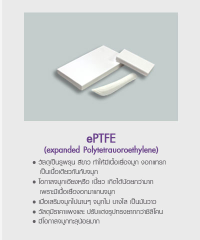 วัสดุที่ใช้ในการเสริมจมูก / ทำจมูก ด้วยซิลิโคนอ่อน และ ePTFE