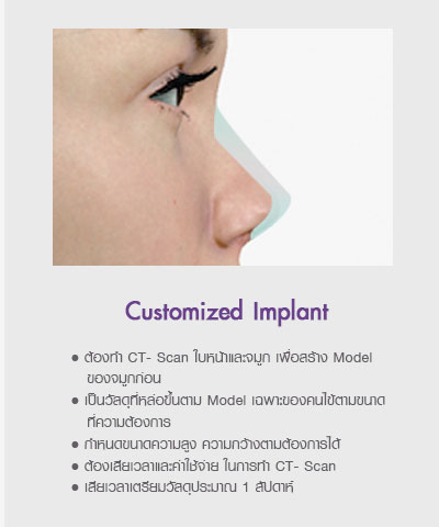 วัสดุที่ใช้ในการเสริมจมูก / ทำจมูก ด้วย Customized Implant