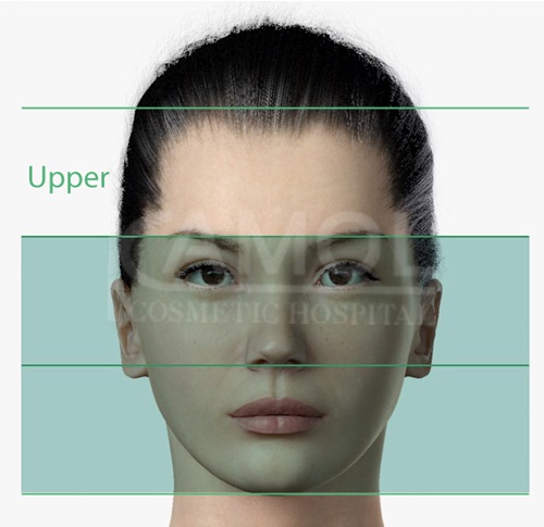 แสดงศัลยกรรมใบหน้าส่วนบน (Upper Part)