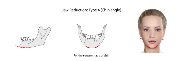 Shows chin