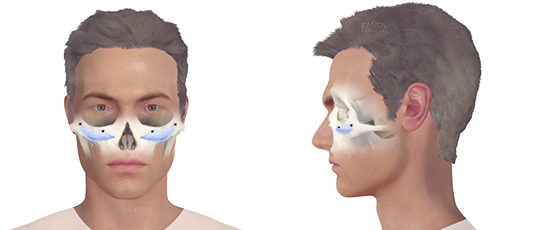 Cheek bones  Contouring