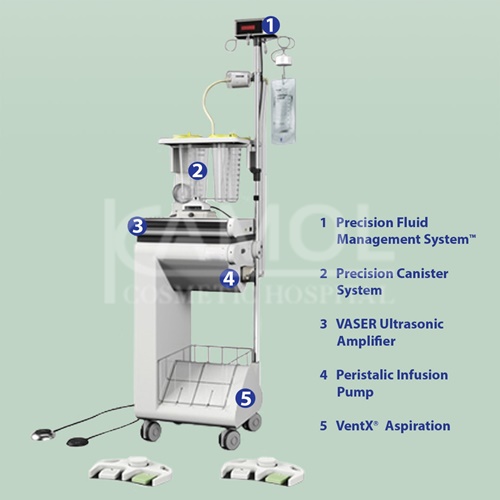  VASER- Assisted High-Definition Liposculpture (VAHDL)